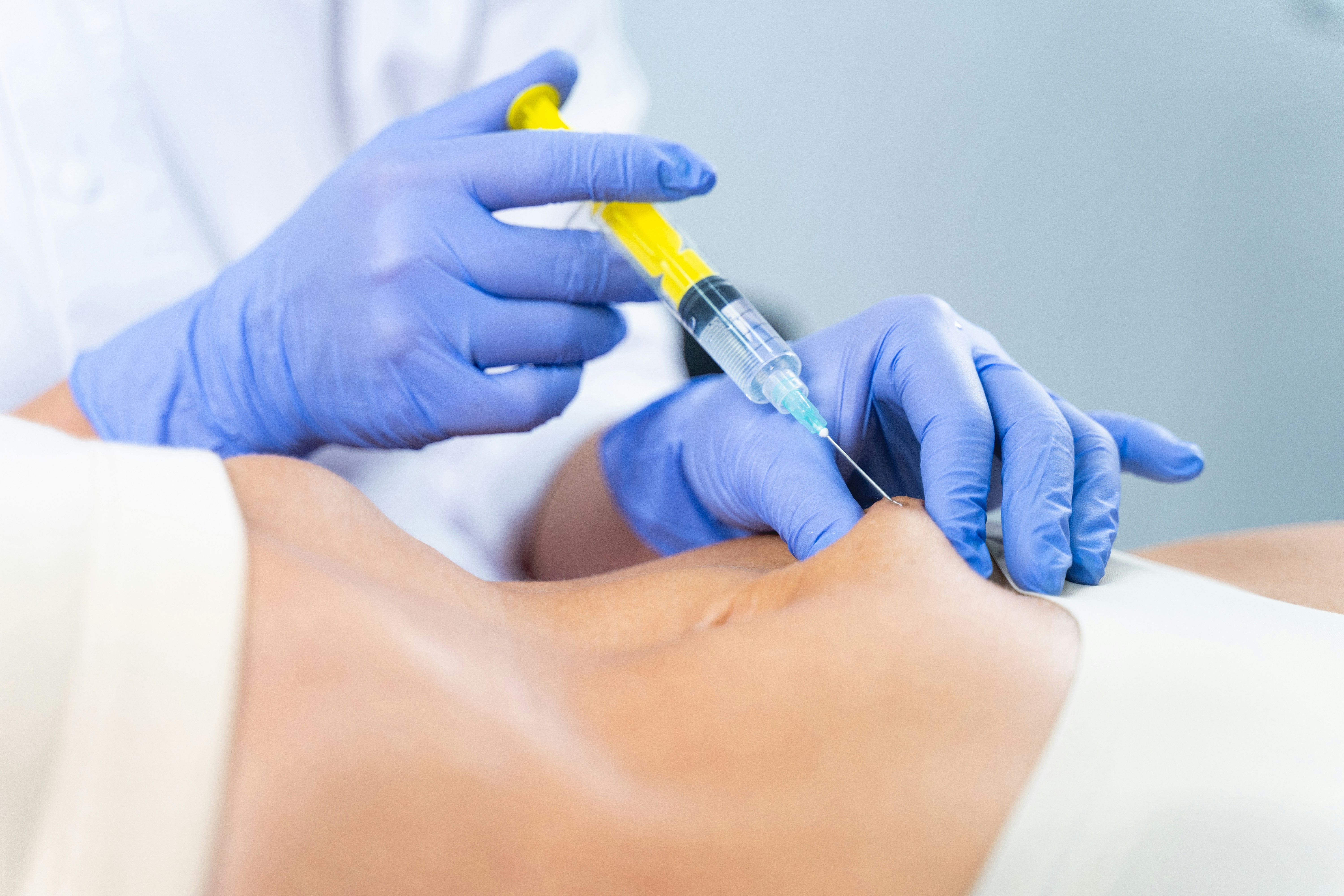 Lip Filler & Anti-Wrinkle Bury | Aesthetics Treatments | Book Now
